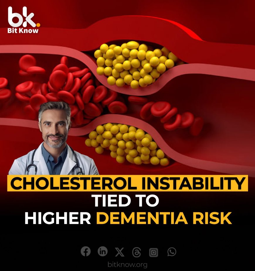 Cholesterol Instability Tied to Higher Dementia Risk